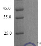 QP10288 CXCL12 / SDF-1 Isoform 1