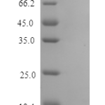 QP10298 CCL22 / MDC