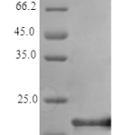 QP10313 IL6 / Interleukin-6 Protein