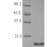 QP10361 Oncostatin M / OSM