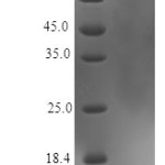 QP10389 IGF1 Isoform 2