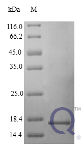 QP10409 IFNG / Interferon Gamma Protein