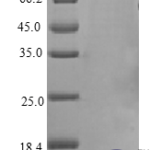 QP10414 NRG1