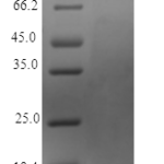 QP10420 NRG1