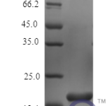 QP10455 IL6 / Interleukin-6 Protein