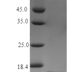 QP10462 IL21 / Interleukin 21