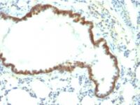 Staining by anti-Ep-CAM / CD326 Antibody 1