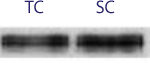 Image showing western blot data demonstrating successful knockdown of ALK by QX1 in SK-N-MC and NB-39-nu Neuroblastoma Cell Lines(TC = Transfection Control, SC = Scrambled siRNA Control, siRNA = QX1 treatment)