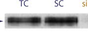 Image showing western blot data demonstrating successful knockdown of ALK by QX1 in SK-N-MC and NB-39-nu Neuroblastoma Cell Lines(TC = Transfection Control, SC = Scrambled siRNA Control, siRNA = QX1 treatment)