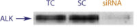 Image showing western blot data demonstrating successful knockdown of ALK by QX1 in SK-N-MC and NB-39-nu Neuroblastoma Cell Lines(TC = Transfection Control, SC = Scrambled siRNA Control, siRNA = QX1 treatment)