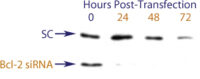 Western blot data demonstrating successful knockdown of Bcl-2 by QX10 at 48 hrs post transfection (SC = Scrambled Control (Product Number QC1), siRNA = QX10 treatment)