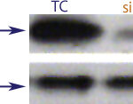 Western blot data demonstrating successful knockdown of Bcl-2 by QX11 at 120 hrs post transfection (SC = Scrambled Control (Product Number QC1), siRNA = QX11 treatment)