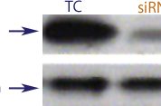 Western blot data demonstrating successful knockdown of Bcl-2 by QX11 at 120 hrs post transfection (SC = Scrambled Control (Product Number QC1), siRNA = QX11 treatment)