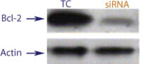 Western blot data demonstrating successful knockdown of Bcl-2 by QX11 at 120 hrs post transfection (SC = Scrambled Control (Product Number QC1), siRNA = QX11 treatment)