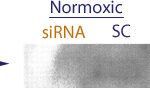 Western blot data demonstrating successful knockdown of Hif-1 alpha following anoxic treatment by QX12 at 48 hrs post transfection (SC = Scrambled Control (Product Number QC1), siRNA = QX12 treatment)