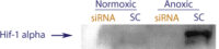 Western blot data demonstrating successful knockdown of Hif-1 alpha following anoxic treatment by QX12 at 48 hrs post transfection (SC = Scrambled Control (Product Number QC1), siRNA = QX12 treatment)