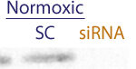 Western blot data demonstrating successful knockdown of Hif-1 alpha following anoxic treatment by QX13 at 48 hrs post transfection (TC = Transfection Control, SC = Scrambled Control (Product Number QC1), siRNA = QX13 treatment)