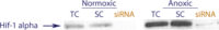 Western blot data demonstrating successful knockdown of Hif-1 alpha following anoxic treatment by QX13 at 48 hrs post transfection (TC = Transfection Control, SC = Scrambled Control (Product Number QC1), siRNA = QX13 treatment)