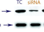 Western blot data demonstrating successful knockdown of Estrogen Receptor (ER) by QX14 at 48 hrs post transfection (TC = Transfection Control, SC = Scrambled Control (Product Number QC1), siRNA = QX14 treatment)