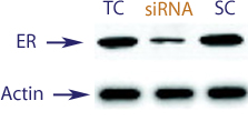 Western blot data demonstrating successful knockdown of Estrogen Receptor (ER) by QX14 at 48 hrs post transfection (TC = Transfection Control, SC = Scrambled Control (Product Number QC1), siRNA = QX14 treatment)