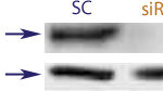 Western blot data demonstrating successful knockdown of Estrogen Receptor (ER) by QX15 at 72 hrs post transfection (SC = Scrambled Control (Product Number QC1), siRNA = QX15 treatment)