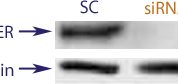 Western blot data demonstrating successful knockdown of Estrogen Receptor (ER) by QX15 at 72 hrs post transfection (SC = Scrambled Control (Product Number QC1), siRNA = QX15 treatment)