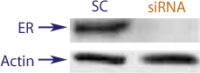 Western blot data demonstrating successful knockdown of Estrogen Receptor (ER) by QX15 at 72 hrs post transfection (SC = Scrambled Control (Product Number QC1), siRNA = QX15 treatment)