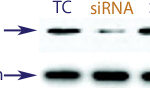 Western blot data demonstrating successful knockdown of Estrogen Receptor (ER) by QX16 at 48 hrs post transfection (TC = Transfection Control, SC = Scrambled Control (Product Number QC1), siRNA = QX16 treatment)