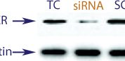 Western blot data demonstrating successful knockdown of Estrogen Receptor (ER) by QX16 at 48 hrs post transfection (TC = Transfection Control, SC = Scrambled Control (Product Number QC1), siRNA = QX16 treatment)