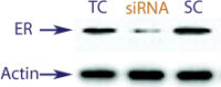 Western blot data demonstrating successful knockdown of Estrogen Receptor (ER) by QX16 at 48 hrs post transfection (TC = Transfection Control, SC = Scrambled Control (Product Number QC1), siRNA = QX16 treatment)