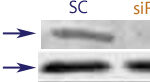 Western blot data demonstrating successful knockdown of Estrogen Receptor Beta (ERBeta) by QX17 at 72 hrs post transfection (SC = Scrambled Control (Product Number QC1), siRNA = QX17 treatment)