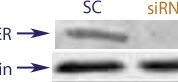 Western blot data demonstrating successful knockdown of Estrogen Receptor Beta (ERBeta) by QX17 at 72 hrs post transfection (SC = Scrambled Control (Product Number QC1), siRNA = QX17 treatment)
