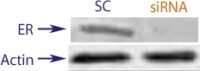 Western blot data demonstrating successful knockdown of Estrogen Receptor Beta (ERBeta) by QX17 at 72 hrs post transfection (SC = Scrambled Control (Product Number QC1), siRNA = QX17 treatment)