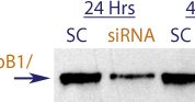 Western blot data demonstrating successful knockdown of EGFR / ErbB1 / Her1 by QX18.  Knockdown of protein is more optimal at 48 hrs post transfection (SC = Scrambled Control (Product Number QC1), siRNA = QX18 treatment)