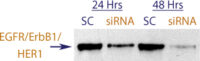 Western blot data demonstrating successful knockdown of EGFR / ErbB1 / Her1 by QX18.  Knockdown of protein is more optimal at 48 hrs post transfection (SC = Scrambled Control (Product Number QC1), siRNA = QX18 treatment)