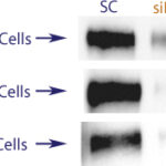 Western blot data demonstrating successful knockdown of ErbB2 / Her2 by QX19.  Knockdown of protein greater than 70% relative to control in ErbB2 / Her2 overexpressing SKBR3 and BT474 cells  and wild type MCF7 cells (97% efficiency in MCF-7 cells) (SC = Scrambled Control (Product Number QC1), siRNA = QX19 treatment)