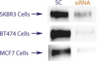 Western blot data demonstrating successful knockdown of ErbB2 / Her2 by QX19.  Knockdown of protein greater than 70% relative to control in ErbB2 / Her2 overexpressing SKBR3 and BT474 cells  and wild type MCF7 cells (97% efficiency in MCF-7 cells) (SC = Scrambled Control (Product Number QC1), siRNA = QX19 treatment)