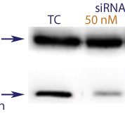 Western blot data demonstrating successful knockdown of SNCA1 by QX2 (TC = Transfection Control, siRNA = QX2 treatment)