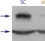 Flow Cytometry data demonstrating successful knockdown of ErbB4 / Her4 72 hours after treatment with QX21 siRNA (SC = Scrambled Control (Product Number QC1), siRNA = QX21 treatment)