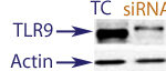 Western Blot data demonstrating successful knockdown of TLR9 in human cells 48 hours after treatment with QX28 siRNA (TC = Transfection Control, siRNA = QX28 treatment)