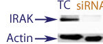 Western Blot data demonstrating successful knockdown of IRAK4 in human cells 48 hours after treatment with QX29 siRNA (TC = Transfection Control, siRNA = QX29 treatment)