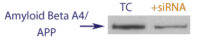 Western blot data demonstrating successful knockdown of Amyloid beta A4 Protein by QX3 (TC = Transfection Control, siRNA = QX3 treatment)