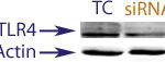 Western Blot data demonstrating successful knockdown of TLR4 in human cells 48 hours after treatment with QX30 siRNA (SC = Scrambled Control (Product Number QC1), siRNA = QX30 treatment)