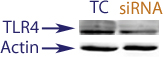 Western Blot data demonstrating successful knockdown of TLR4 in human cells 48 hours after treatment with QX30 siRNA (SC = Scrambled Control (Product Number QC1), siRNA = QX30 treatment)