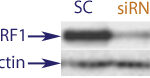 Western Blot data demonstrating successful knockdown of p53 in human cells 48 hours after treatment with QX33 siRNA and IFN gamma(SC = Scrambled Control (Product Number QC1), siRNA = QX33 treatment)