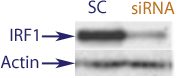 Western Blot data demonstrating successful knockdown of p53 in human cells 48 hours after treatment with QX33 siRNA and IFN gamma(SC = Scrambled Control (Product Number QC1), siRNA = QX33 treatment)