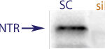 Western Blot data demonstrating successful knockdown of Nerve growth factor receptor / p75NTR in rat cells after treatment with QX35 siRNA (SC = Scrambled Control (Product Number QC1), siRNA = QX35 treatment)