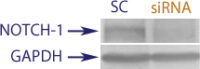 Western blot data demonstrating successful knockdown of Notch-1 in human cells 48 hours after treatment with QX37 siRNA (SC = Scrambled Control (Product Number QC1), siRNA = QX37 treatment)