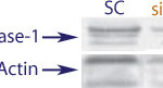 Western blot data demonstrating successful knockdown of UVB irradiation induced Caspase-1 in human cells 72 hours after treatment with QX38 siRNA (SC = Scrambled Control (Product Number QC1), siRNA = QX38 treatment)