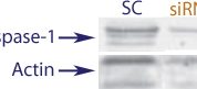 Western blot data demonstrating successful knockdown of UVB irradiation induced Caspase-1 in human cells 72 hours after treatment with QX38 siRNA (SC = Scrambled Control (Product Number QC1), siRNA = QX38 treatment)